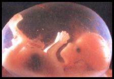 Denuncia: el gigantesco negocio de los embriones humanos